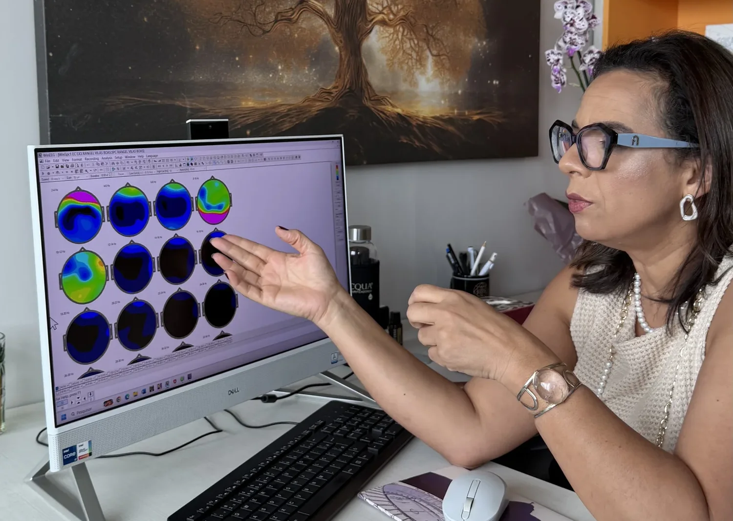 Dra. Valéria Modestto apresentando o mapeamento cerebral (qEEG) na tela